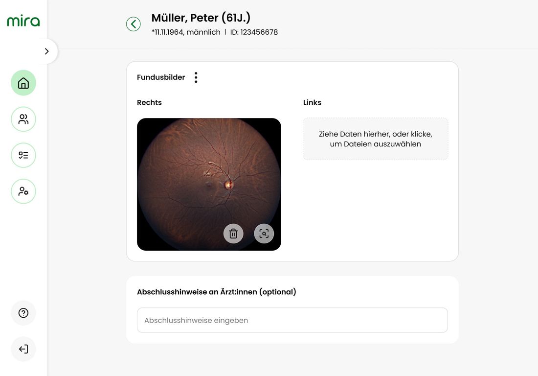 mira App: Fundusbilder im Vorsorge-Screening