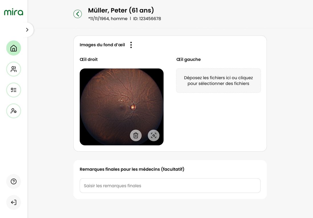Application mira : images du fond d'œil dans le dépistage préventif